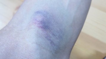 blood0921c.jpg